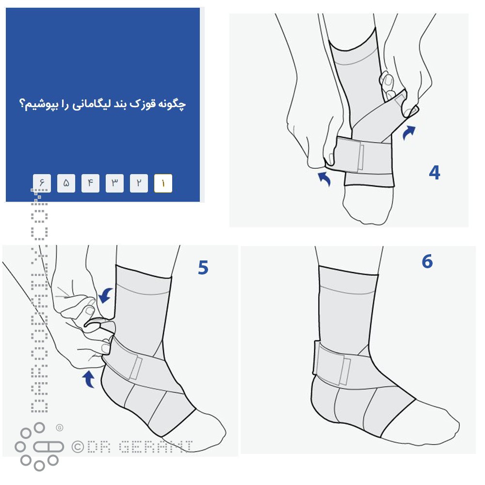 قوزک بند طبی ليگامانی پاک سمن سایز بزرگ