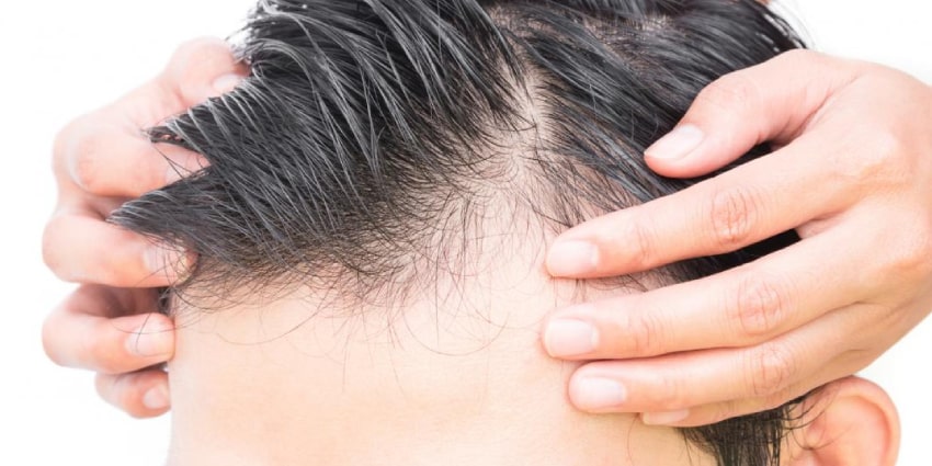 نحوه مصرف دوتاستراید 0.5 میلی‌گرم چگونه است؟