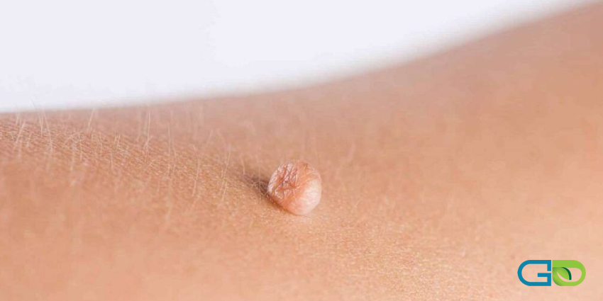 پمادها و شیتهای سیلیکونی واقعا موثرند؟