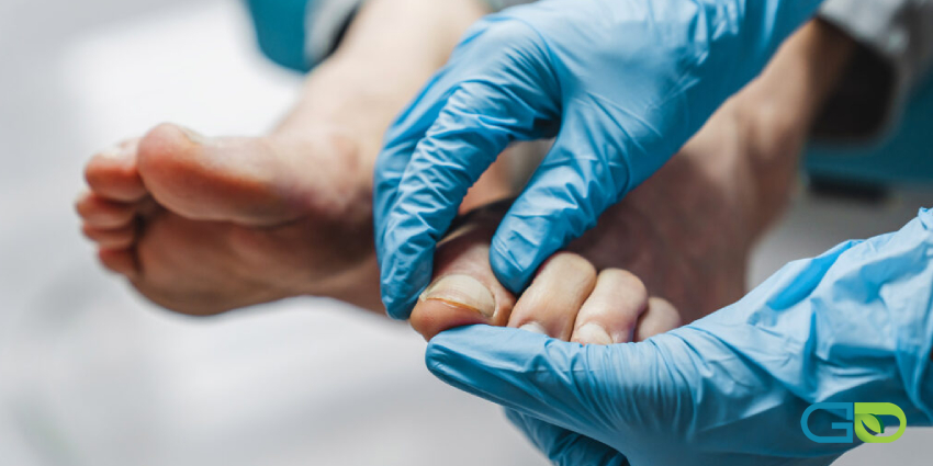 ناخن چگونه از بستر جدا می‌شود؟