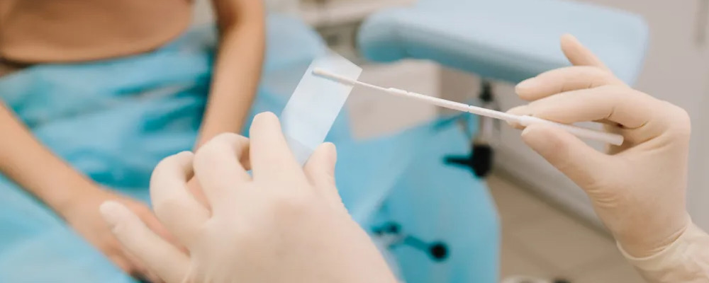 تست پاپ اسمیر؛ از صفر تا صد تفسیر نتایج + زمان دقیق انجام