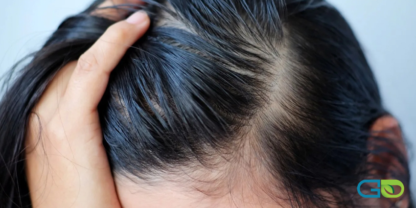 بهترین راهکارها برای درمان کشسانی مو