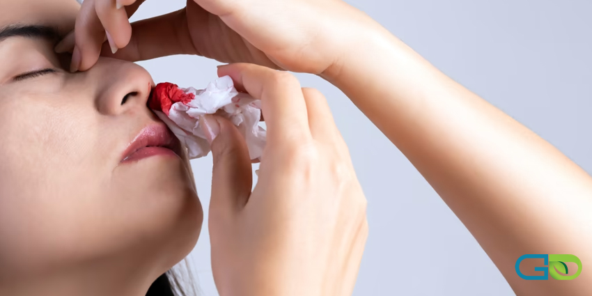 تکنیکهای اصولی برای متوقف کردن خون دماغ در خانه