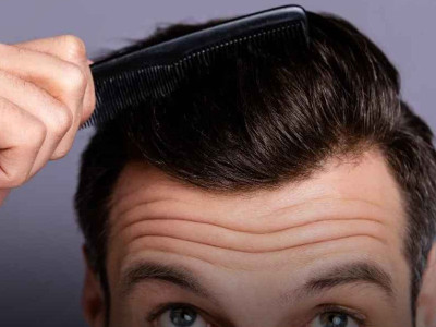 بهترین روش‌ها برای پرپشت شدن مو‌ مردان؛ نکات مهم را یکجا بخوانید